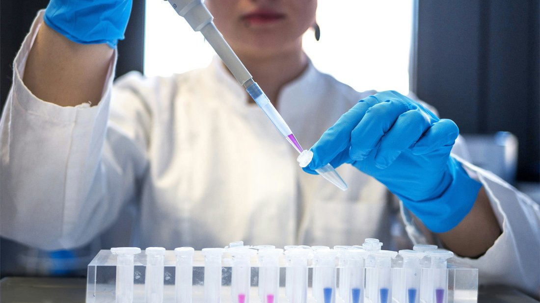 Labormitarbeiterin bei der Vorbereitung von Proben für die Diagnostik – farbige Flüssigkeit wird mit einer Pipette in ein Reagenzglas überführt.