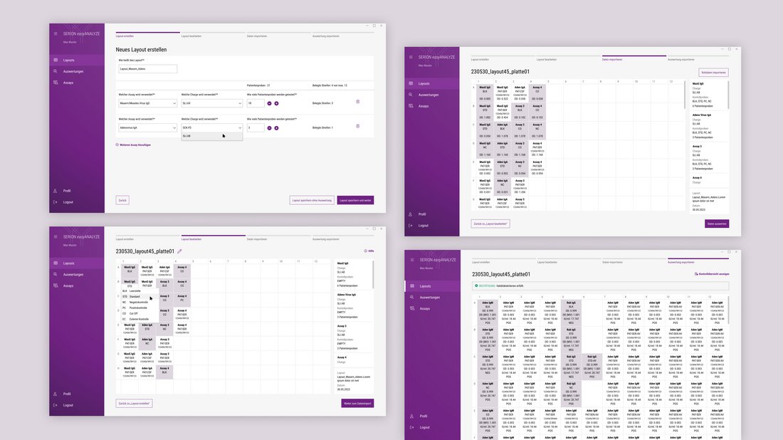 Vier Screenshots der Software SERION easyANALYZE, die den Prozess zur Erstellung, Bearbeitung und Auswertung von Layouts für diagnostische Assays zeigen – von der Eingabe der Assay-Daten bis zur finalen Ergebnisauswertung.